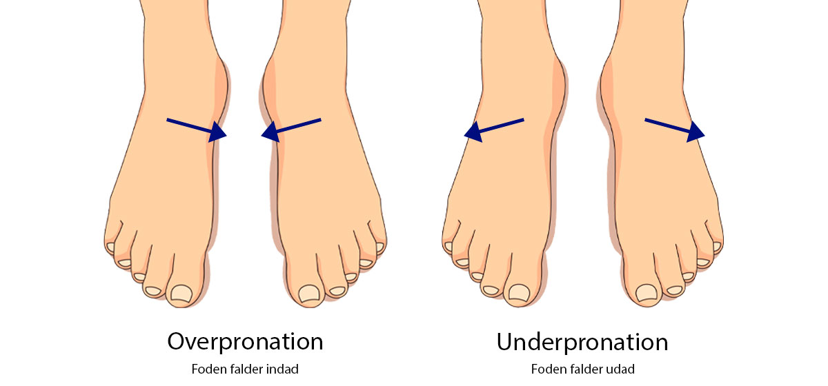 Hvad er forskellen på under- eller overpronation? - Sahva