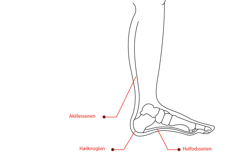 du hælsmerter? -- Læs hælspore, platfod meget